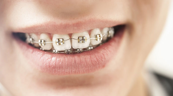 Kiedy udać się na konsultację ortodontyczną